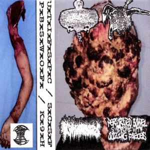 Urinary Tract Infection From Severe Pus Clots / Schizophrenic Cannibalistic Sex Fest / K9 Hemorrhoids / Perforated Bowel Syndrom