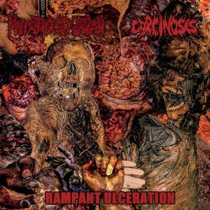 Rampant Ulceration