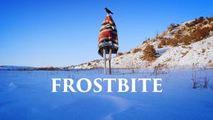 Frostbite