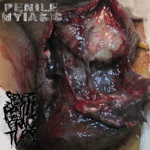 Penile Myiasis/Severe Penile Fracture Split (EP)