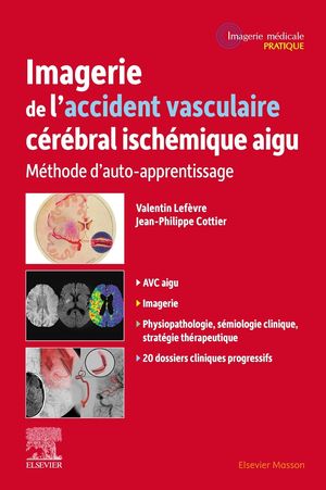Imagerie de l'accident vasculaire cérébral ischémique aigu: Méthode d'auto-apprentissage