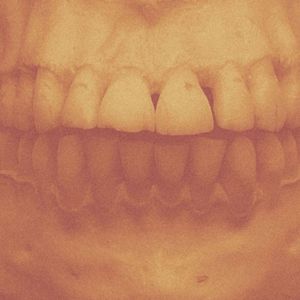 Million Dollar Smile (Single)