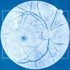 Tresor (EP)