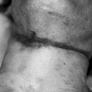 Bound And Chained