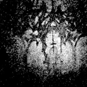 pedals (Single)
