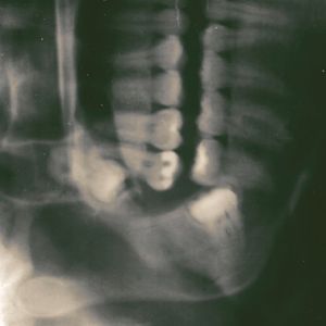 I'M FINE! (Single)