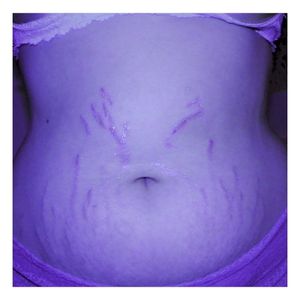 Diet Culture (Single)