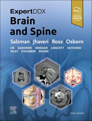 ExpertDDX: Brain and Spine