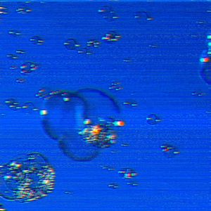 981B84011000