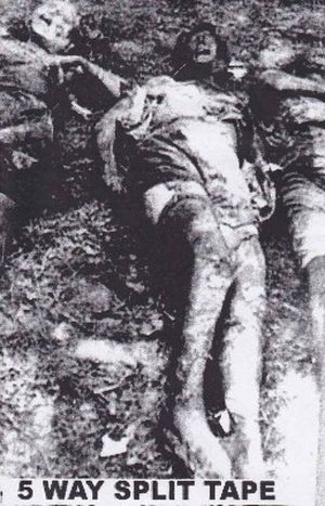 Pulmonary Fibrosis / Cakewet / Vomitrocity / Flesh Disgorged / Copremesis