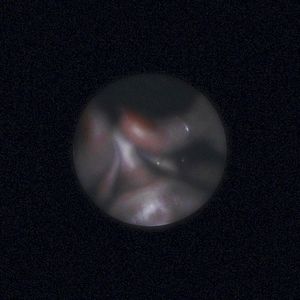 Satellite (Single)