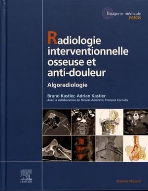 Radiologie interventionnelle osseuse et anti-douleur