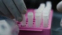 Preventing Future Pandemics