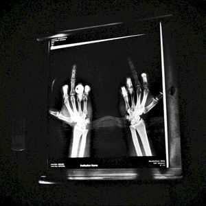 lies (Single)