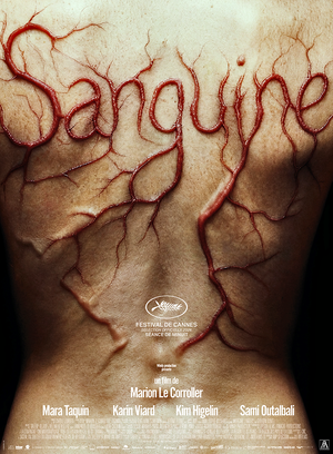 Sanguine