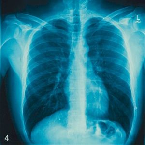 hundert liter (Single)